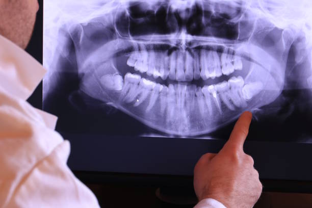 Best Dentist for Severe Toothache  in Park Falls, WI