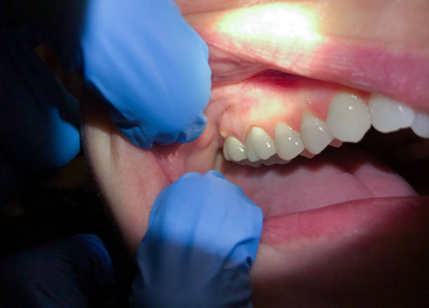 Best Emergency Gum Pain Relief  in Park Falls, WI