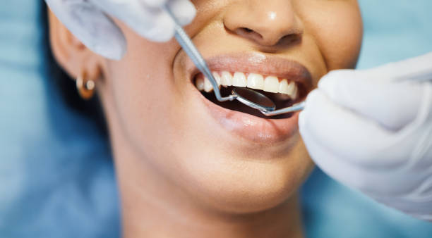 Best Dentist for Tooth Abscess  in Park Falls, WI