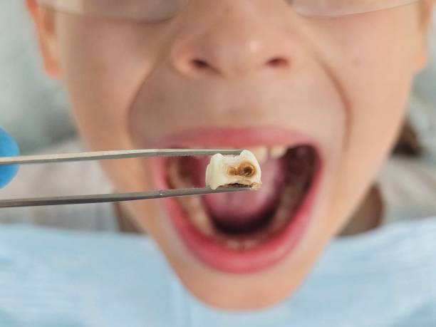 Tooth Infection Emergency Dentist in WI